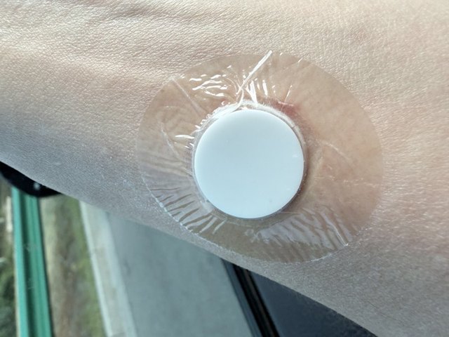 Close-up of a T-Patch on skin